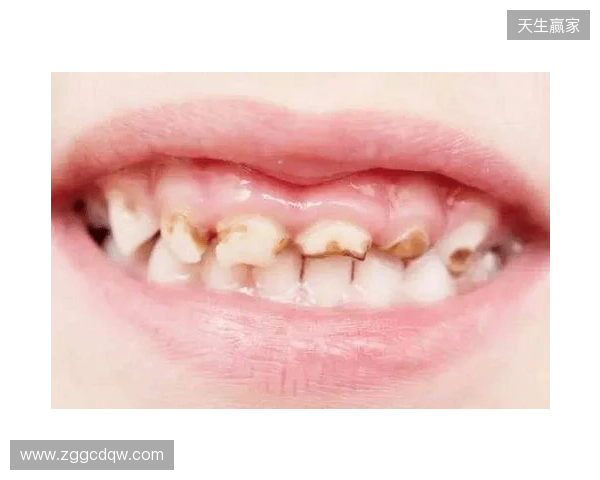 韦林顿确诊上唇部贯通伤；11、21牙半脱位；上颌前牙区牙槽骨骨折